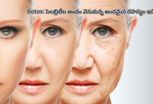 Botox