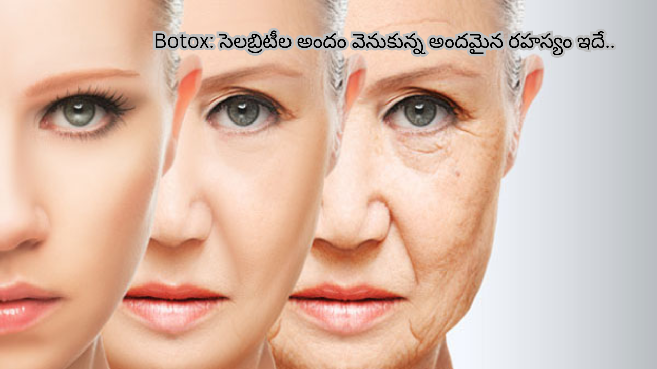 Botox