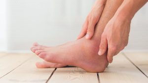 Swollen feet