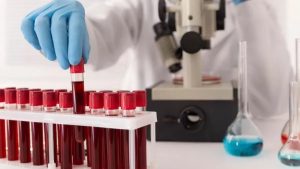 Blood Group