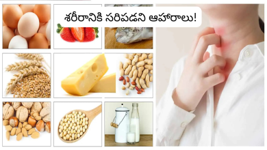 Foods
