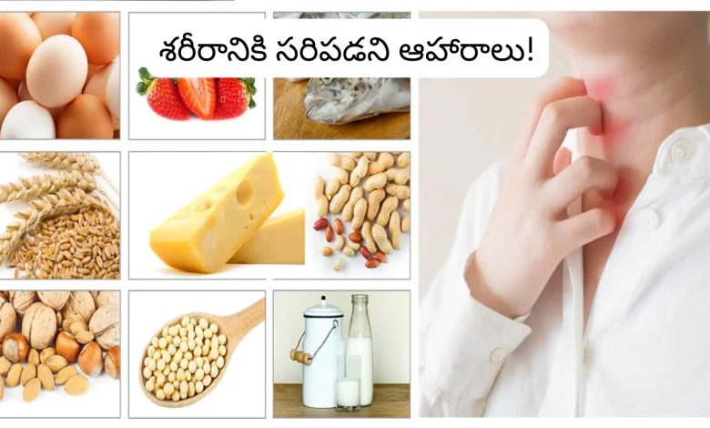 Foods