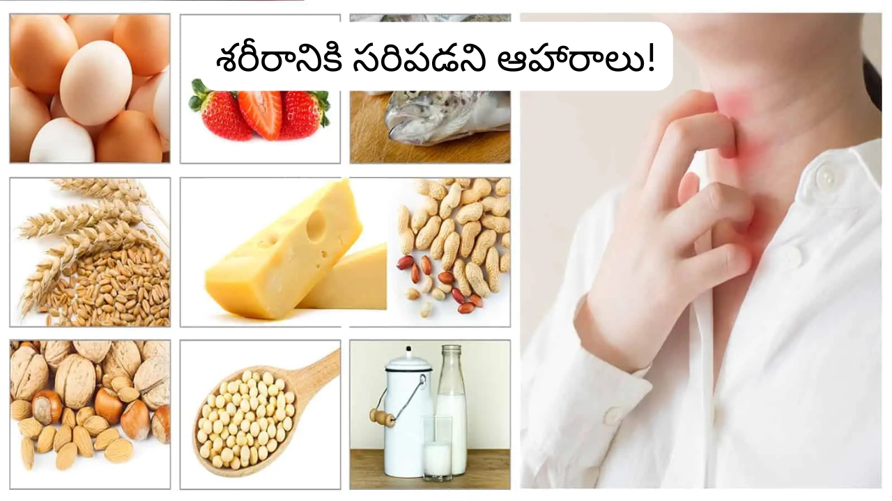 Foods