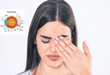 Glaucoma