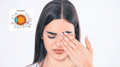 Glaucoma