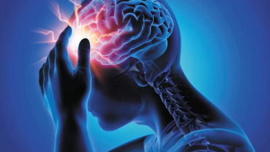 Head injury