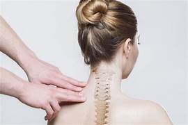 Posture syndrome