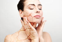 Skin cracking