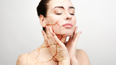 Skin cracking