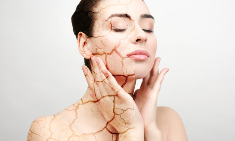 Skin cracking