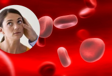 Anemia