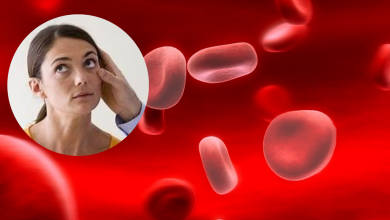 Anemia