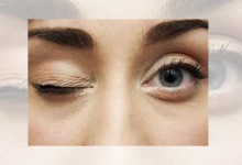 Eye twitch