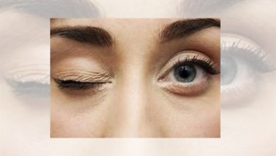Eye twitch