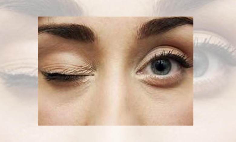 Eye twitch