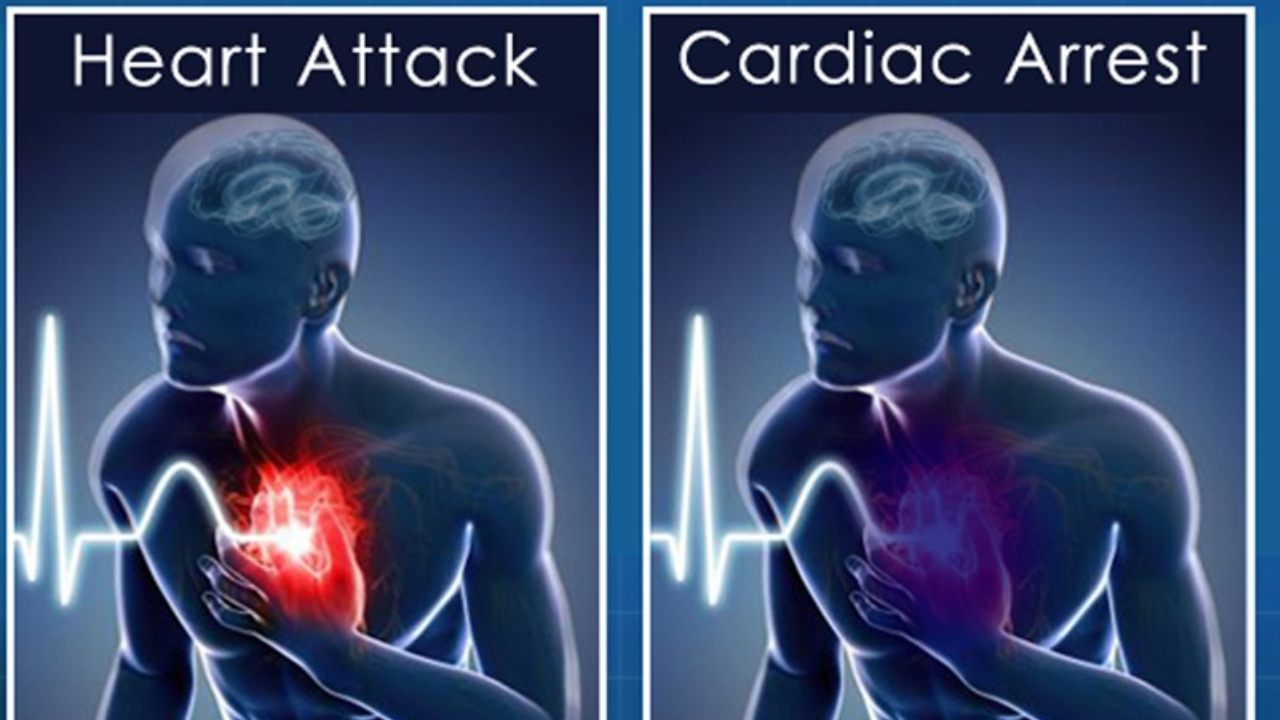 Heart attack