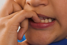 Nail biting