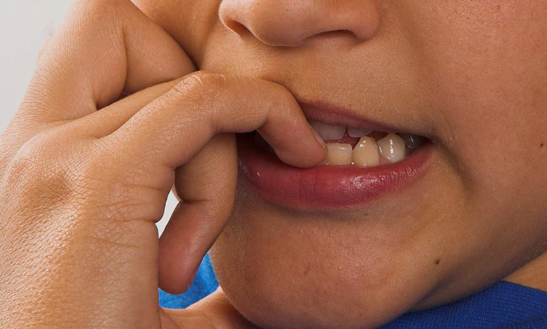 Nail biting